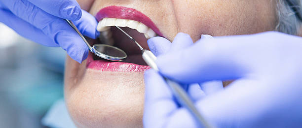 Best Emergency Tooth Extraction in Mojave, CA